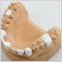 Dental Restorative